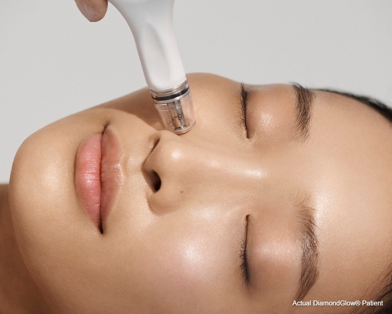 DiamondGlow® Facial - Dulles Office